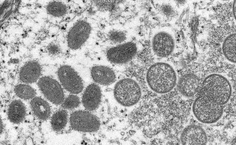 FILE PHOTO: CDC microscopic image shows monkeypox virus particles